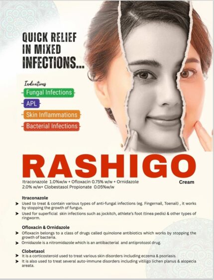 raconazole 1.0% + ofloxacin 0.75% +ornidazole 2.0%+ clobetasol Propionate 0.05%, Propyl Paraben 0.02%